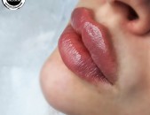 Увеличение губ контурная пластика сертифицированным косметологом с мед образованием 