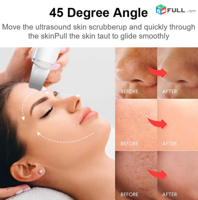 Скребок Xiaomi Mijia ультразвуковой кожи Ultrasonic Skin Scrubber scraper peel machine pore cleaner kosmetolog